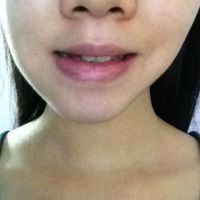 Một bên mặt của tôi to hơn hẳn bên kia, làm thế nào để mặt tôi cân đối hơn?