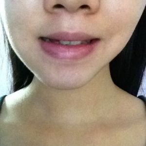 Một bên mặt của tôi to hơn hẳn bên kia, làm thế nào để mặt tôi cân đối hơn?