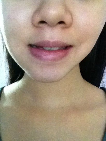 Một bên mặt của tôi to hơn hẳn bên kia, làm thế nào để mặt tôi cân đối hơn? Một bên mặt của tôi to hơn hẳn bên kia, làm thế nào để mặt tôi cân đối hơn?