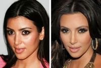 Kim Kardashian và Megan Fox đã làm như thế nào để sở hữu khuôn mặt hiện tại?