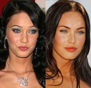 Kim Kardashian và Megan Fox đã làm như thế nào để sở hữu khuôn mặt hiện tại?