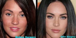 Kim Kardashian và Megan Fox đã làm như thế nào để sở hữu khuôn mặt hiện tại?