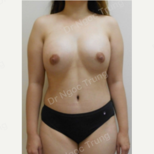 Combo ngực bụng Dr Ngọc Trung - ca 3