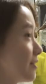 Da mũi mỏng, sống mũi rất thấp (gần như không có) thì phải nâng mũi thế nào?