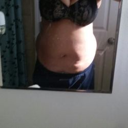 Tôi sẽ gặp những vấn đề gì khi làm combo ngực bụng và liệu có khả năng bị lên cơn đau tim hoặc gặp các biến chứng khác nếu làm phẫu thuật hay không?