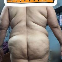 Tôi nặng đến 122 kg thì có thể làm combo ngực bụng được không?