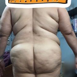 Tôi nặng đến 122 kg thì có thể làm combo ngực bụng được không?