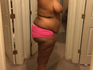 Tôi muốn làm combo ngực bụng ở tuổi 34, nặng 108 kg và cao 1m76, thì có được không?