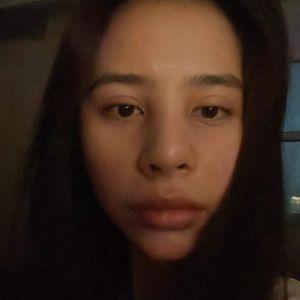 Mũi 8 tháng bị sưng do bầu hay do dị ứng chất liệu hay nhiễm trùng ạ ?