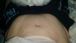 Cơ co thắt bất thường sau combo ngực bụng, tôi nên làm gì?