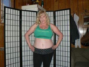 Đã 8 tuần kể từ khi làm tạo hình thành bụng, treo ngực sa trễ, hút mỡ mà sao cơ thể không cải thiện gì thêm?