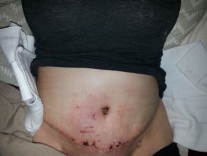 Tôi đang bị nhiễm trùng loại nào vậy?