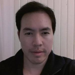 Cấy 3417 nang tóc trong 2 ngày cho giám đốc doanh nghiệp - case 39