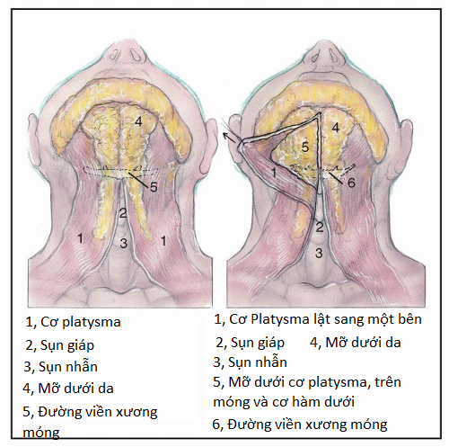 giải phẫu cổ