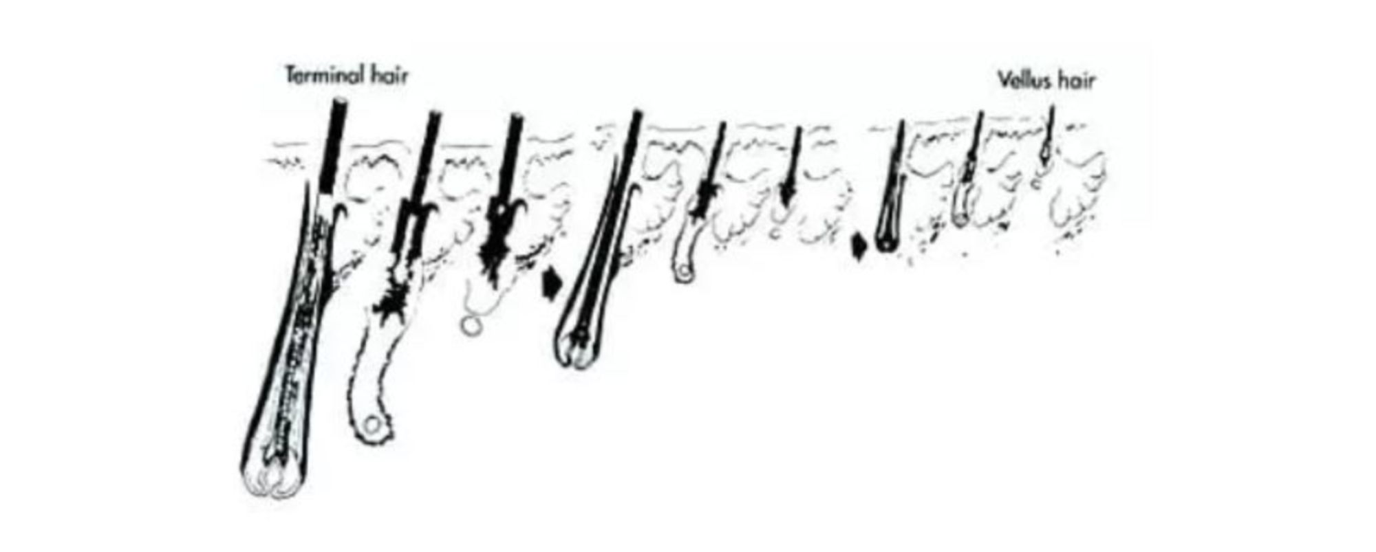 rung toc do di truyen