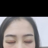 Em xin chào tất cả các vị bác sĩ chuyên môn ở đây ạ .