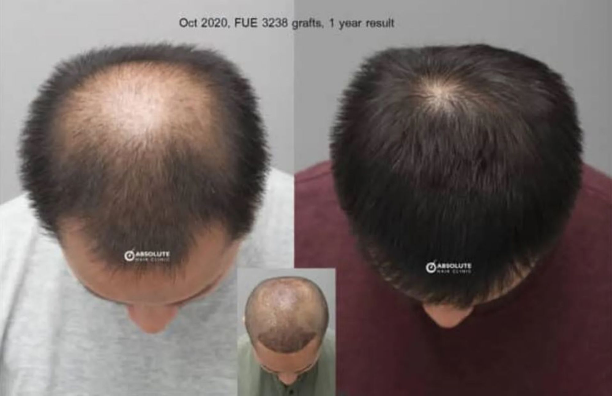 cay toc hoi dinh dau