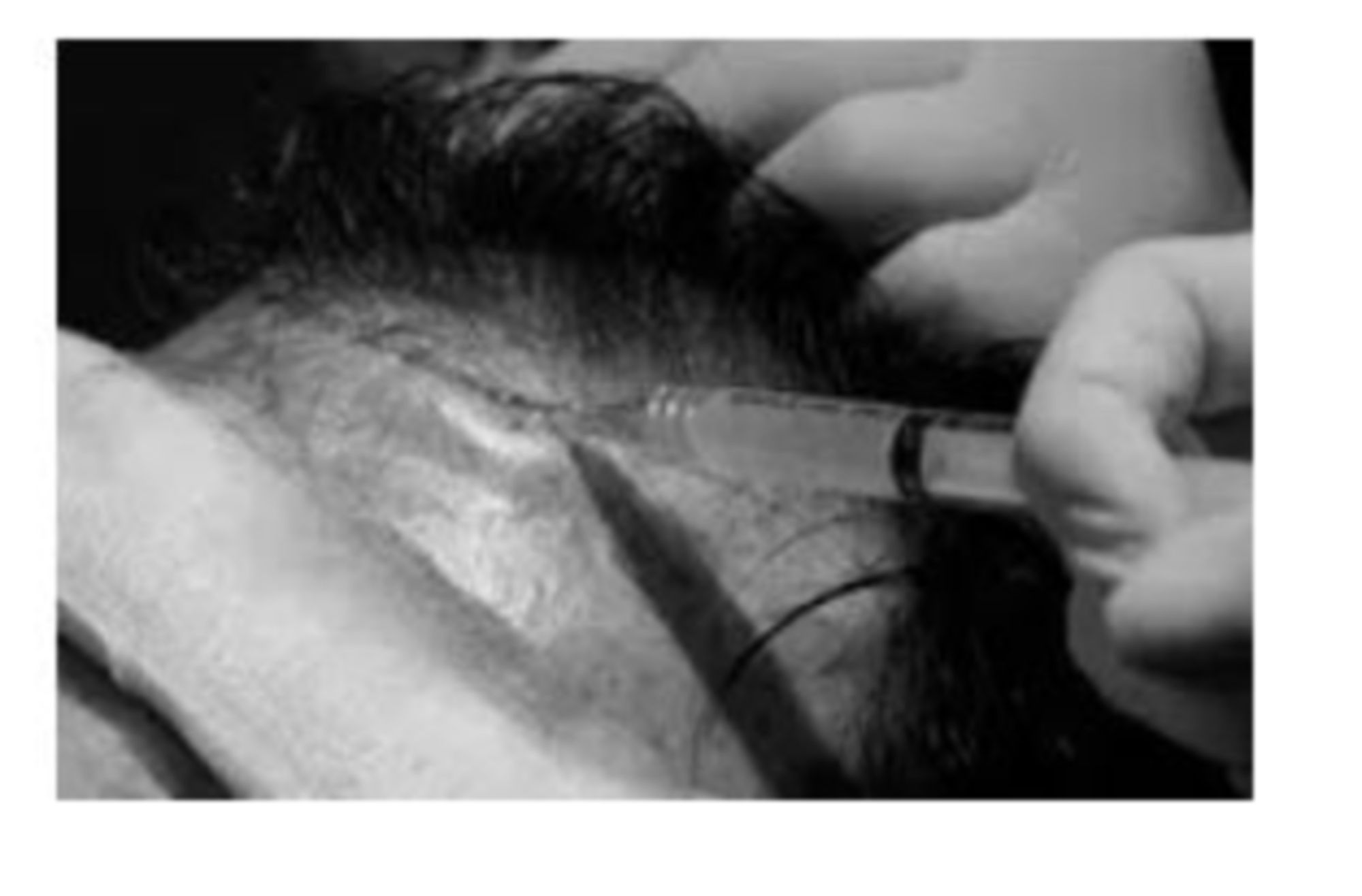 quy trinh cay toc 10