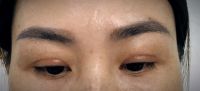 CẮT MÍ SƯNG KHÔNG ĐỀU