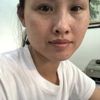 CẮT MÍ SƯNG KHÔNG ĐỀU