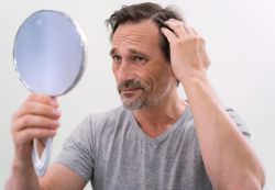 Hormone DHT là gì? Có liên quan gì đến rụng tóc, tóc thưa mỏng và hói đầu?