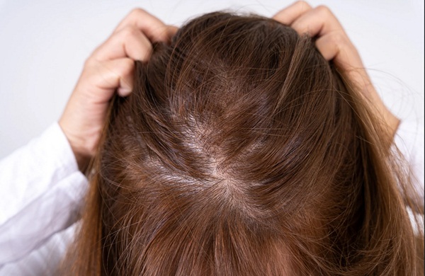9 cách giúp tóc chắc khỏe đơn giản từ trong ra ngoài • Hello Bacsi