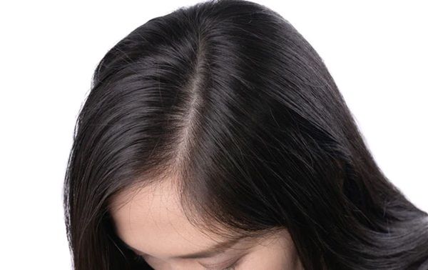 Cách giữ mái tóc sạch gàu