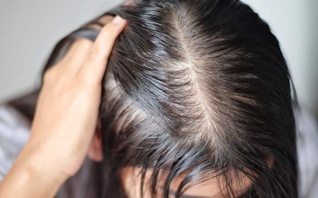10 vấn đề về tóc và cách khắc phục