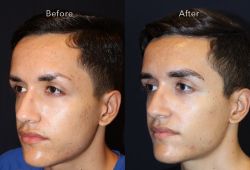 Tại Sao Ngày Càng Có Nhiều Nam Giới Chọn Cấy Lông Mày