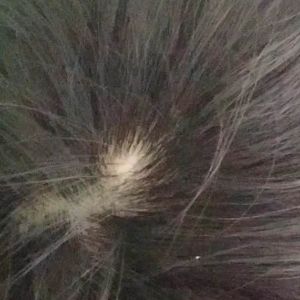 cho mình hỏi như này thì bao lâu tóc mọc lại vậy ạ