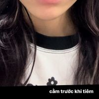 Tiêm tan filler cằm Tiêm tan filler cằm