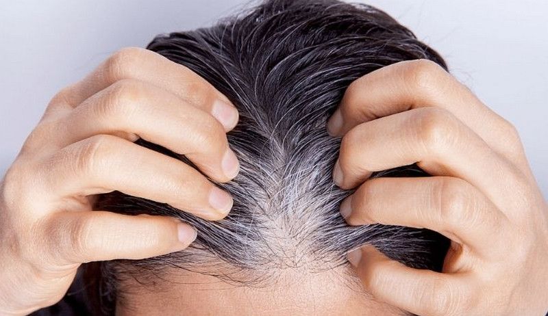 Cách điều trị tóc sâu rụng