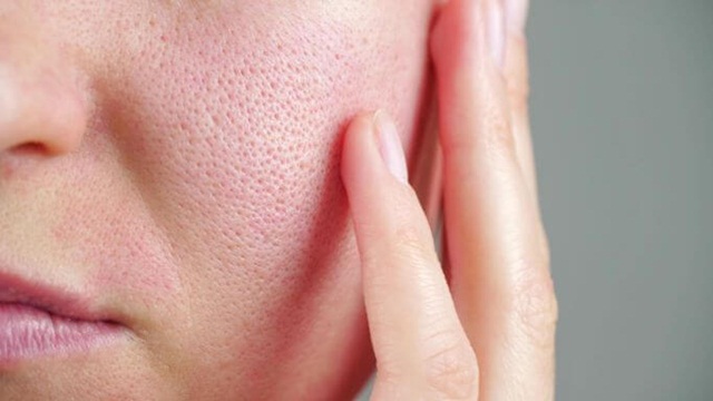 Các Cách Thu Nhỏ Lỗ Chân Lông