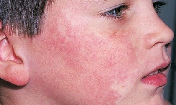 do mat sau khi tap the duc