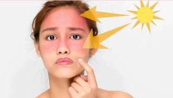 Retinol Có Khiến Da Nhạy Cảm Với Ánh Nắng Mặt Trời Không?