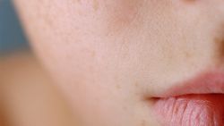 Mất Nước, Viêm, Tăng Sắc Tố Và Lão Hóa - Nguồn Gốc Của Mọi Vấn Đề Về Da