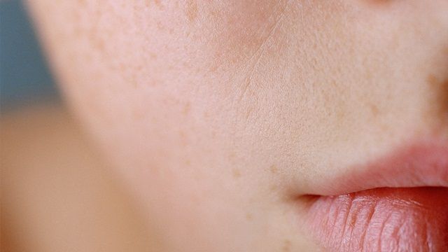 Mất Nước, Viêm, Tăng Sắc Tố Và Lão Hóa - Nguồn Gốc Của Mọi Vấn Đề Về Da