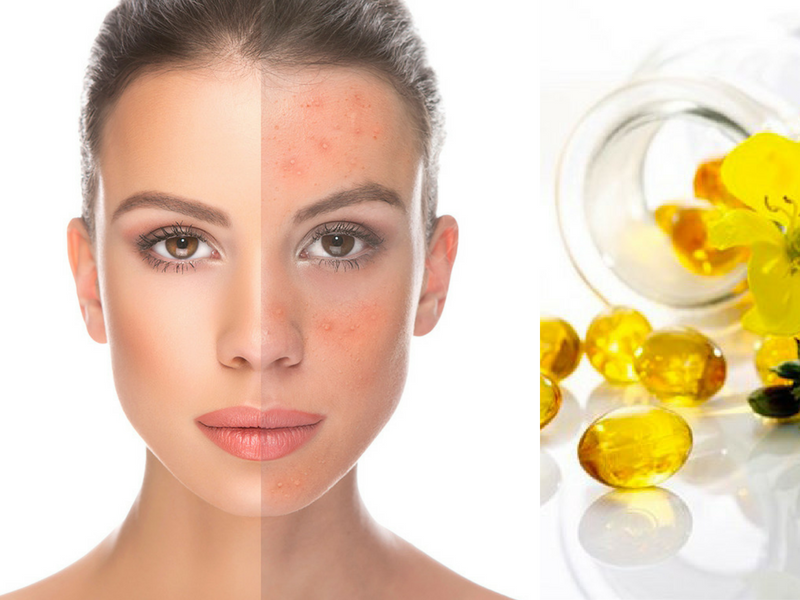 tác dụng của dầu hoa anh thảo đối với da