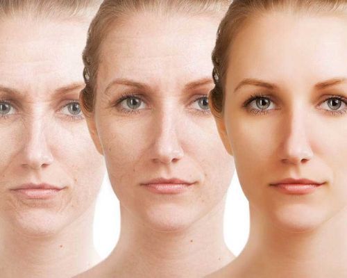 ngan ngua lao hoa da