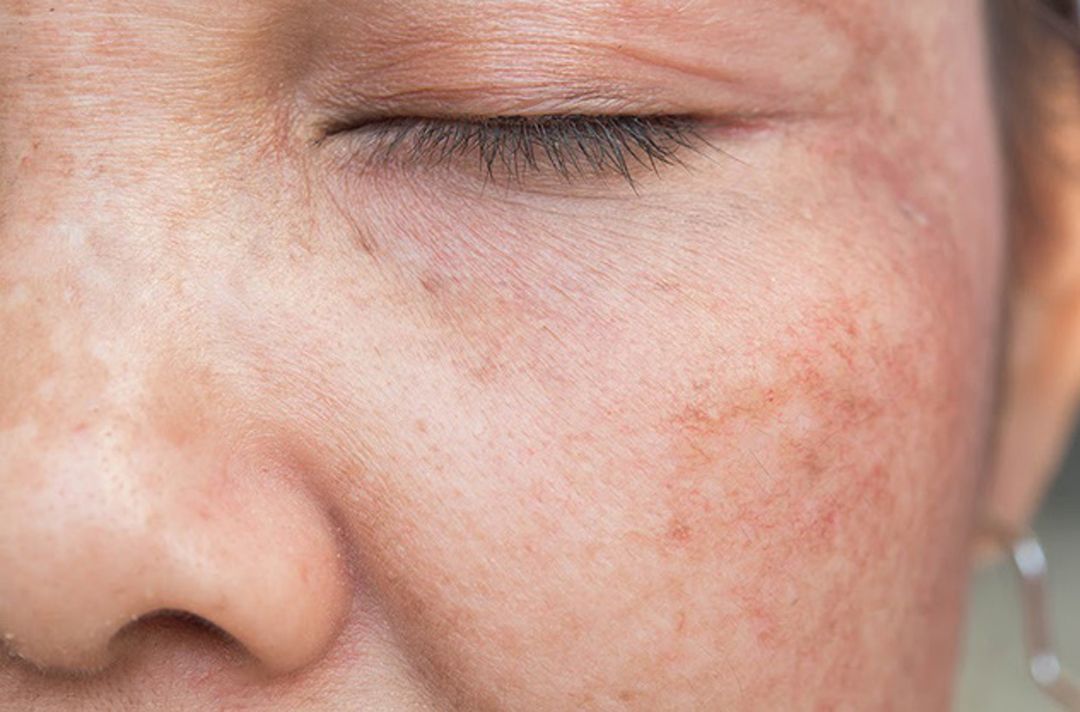 nhung dieu ban can biet ve tang sac to