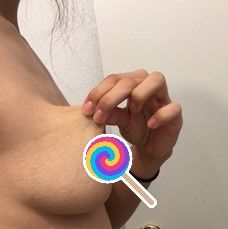 Muốn nâng ngực sau sinh