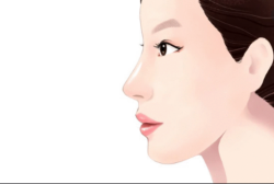 Sụn nâng mũi lung lay, dịch chuyển và lệch sống: phải làm sao?