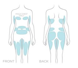 6 vùng trên cơ thể có thể cải thiện nhờ hút mỡ