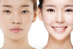 Bấm mí và cắt mí: nên chọn cái nào, khác nhau ra sao?