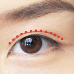 Mắt to đẹp, bền lâu với công nghệ bấm mí đa điểm (Multi Point)