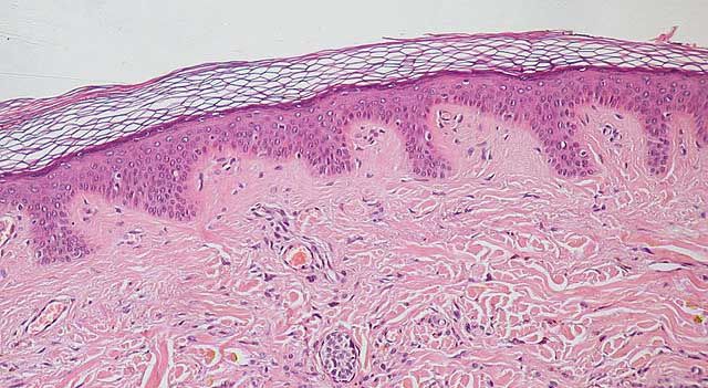 Biểu bì gồm có những lớp nào?