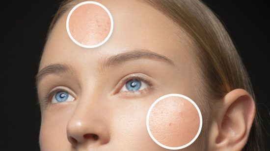 Các tip chăm sóc da dầu