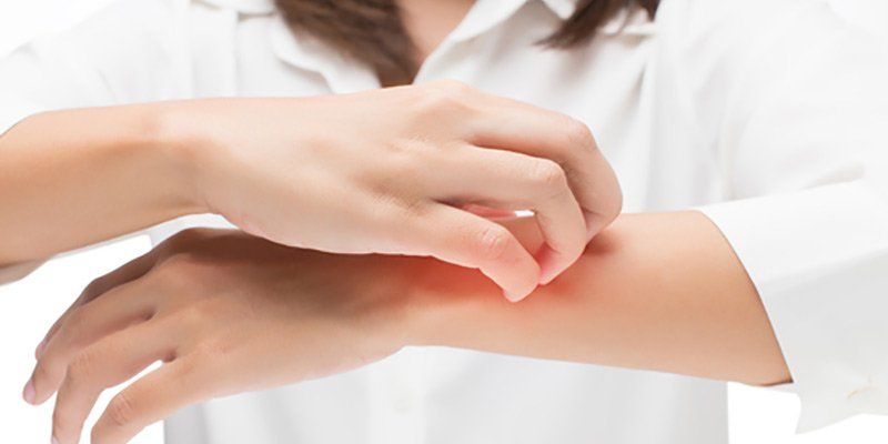 Cách chăm sóc da bị eczema