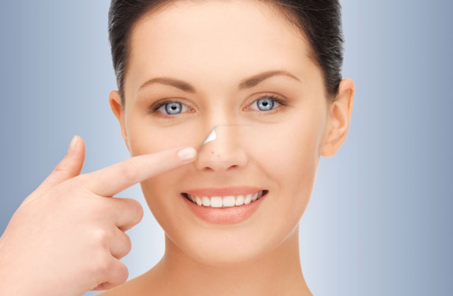 Các phương pháp hiệu quả nhất để trị mụn vùng mũi