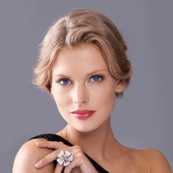 Răng hô vẩu và cằm lẹm nên niềng răng hay độn cằm?